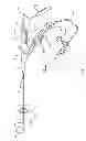 Fig. 02 - Impact lithotripsy tip