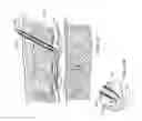 Fig. 43 - Assembly for percutaneously inserting an implantable medical device, steering the device to a target location and deploying the device