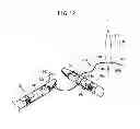 Fig. 13 - Suturing and ligating method