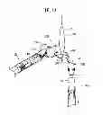 Fig. 15 - Suturing and ligating method