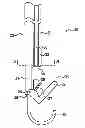 Fig. 01 - Tissue fastening devices and related insertion tools and methods
