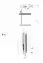 Fig. 02 - Devices, systems and methods for creation of a peripherally located fistula