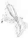 Fig. 02 - HORIZONTAL PHLEBECTOMY DEVICE