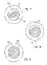 Fig. 06 - Blunt tip obturator