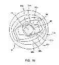 Fig. 07 - Blunt tip obturator
