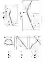 Fig. 07 - Systems for locking a cinch loop in tissue repair