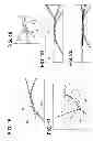 Fig. 08 - Systems for locking a cinch loop in tissue repair