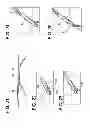 Fig. 09 - Systems for locking a cinch loop in tissue repair