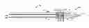 Fig. 01 - Suture anchor