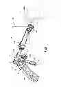 Fig. 02 - Orthopedic implant system