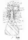 Fig. 13 - Orthopedic implant system