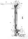 Fig. 14 - Orthopedic implant system
