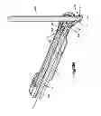 Fig. 19 - Orthopedic implant system
