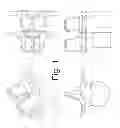 Fig. 02 - SPINOUS PROCESS FUSION AND ORTHOPEDIC IMPLANTS AND METHODS