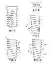 Fig. 03 - Methods for delivery of screws for joint fusion