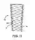 Fig. 04 - Methods for delivery of screws for joint fusion