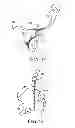 Fig. 05 - Methods for delivery of screws for joint fusion