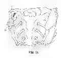 Fig. 07 - Methods for delivery of screws for joint fusion