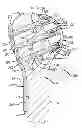 Fig. 01 - System and method for fracture replacement of comminuted bone fractures or portions thereof adjacent bone joints