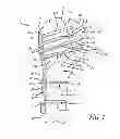 Fig. 02 - System and method for fracture replacement of comminuted bone fractures or portions thereof adjacent bone joints