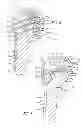 Fig. 04 - System and method for fracture replacement of comminuted bone fractures or portions thereof adjacent bone joints