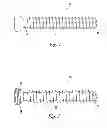 Fig. 02 - Bone plating system