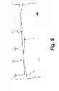 Fig. 07 - Orthopedic connections