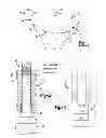 Fig. 02 - Method of implanting a knee prosthesis based on bone density
