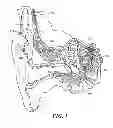 Fig. 02 - Temporal coding for hearing implants