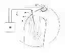 Fig. 01 - SYSTEMS AND METHODS TO PLACE ONE OR MORE LEADS IN MUSCLE FOR PROVIDING ELECTRICAL STIMULATION TO TREAT PAIN