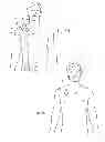 Fig. 03 - SYSTEMS AND METHODS TO PLACE ONE OR MORE LEADS IN MUSCLE FOR PROVIDING ELECTRICAL STIMULATION TO TREAT PAIN