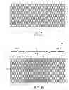 Fig. 02 - Methods and systems for increasing a density of a region of a vascular device