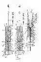 Fig. 04 - Loading apparatus and system for expandable intraluminal medical devices