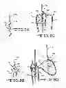 Fig. 08 - Loading apparatus and system for expandable intraluminal medical devices