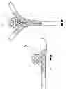 Fig. 04 - Wing bifurcation reconstruction device