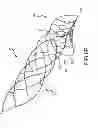 Fig. 09 - Wing bifurcation reconstruction device