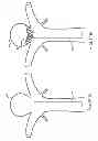 Fig. 22 - Wing bifurcation reconstruction device