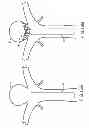 Fig. 28 - Wing bifurcation reconstruction device