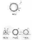 Fig. 03 - Post-implantation contractible or expandable devices and method of using and making the same