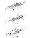 Fig. 07 - Post-implantation contractible or expandable devices and method of using and making the same