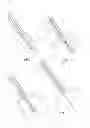 Fig. 04 - Methods for transluminal delivery of prosthetic valves