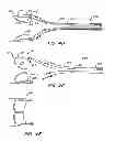 Fig. 07 - REPLACEMENT VALVE AND ANCHOR