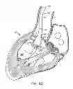 Fig. 09 - REPLACEMENT VALVE AND ANCHOR