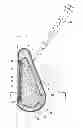 Fig. 01 - INFLATABLE PROSTHESES AND METHODS OF MAKING SAME