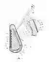 Fig. 02 - INFLATABLE PROSTHESES AND METHODS OF MAKING SAME