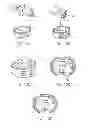 Fig. 09 - Stand-alone interbody fixation system