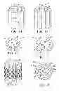 Fig. 06 - EXPANDABLE INTERBODY IMPLANT AND METHOD