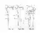Fig. 09 - Bone joint replacement and repair assembly and method of repairing and replacing a bone joint