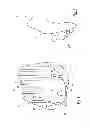 Fig. 02 - Set of femoral implants for a knee prothesis