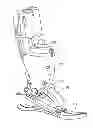 Fig. 01 - Controlling torque in a prosthesis or orthosis based on a deflection of series elastic element